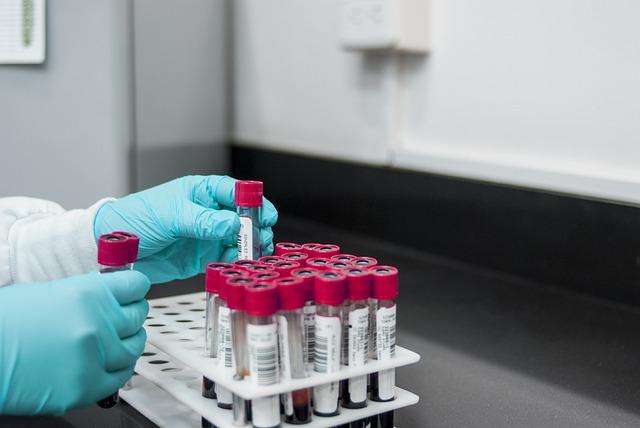 Benefits Of Health Screening That May Change Your Perspective