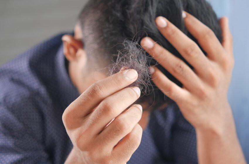Propecia (Finpecia) 1 mg: Effective Hair Loss Treatment